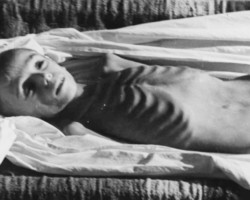 A child exhausted in exile before being evacuated from the Soviet Union to India, Vrevskoye near Tashkent, 1942; source: Poles from India Association A child exhausted in exile before being evacuated from the Soviet Union to India, Vrevskoye near Tashkent, 1942; source: Poles from India Association